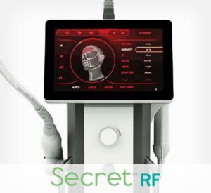 Picture of Secret™ RF
