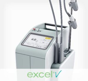 Picture of excel® V