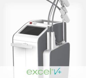 Picture of excel® V+